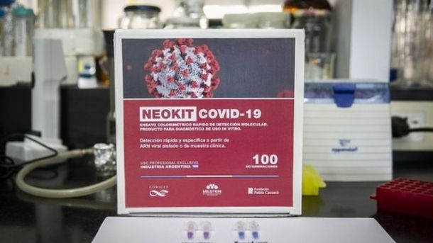 Intensifican la fabricación del test argentino para detectar el coronavirus de U$S8