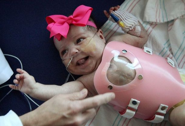 Audrina ya está en vías de recuperarse