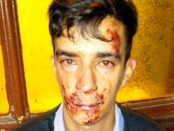 Brutal ataque de una patota a un electricista en La Plata