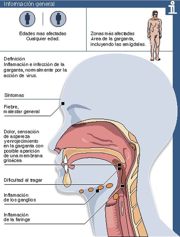 ¿Cómo es el cuadro de salud que padece la Presidenta?