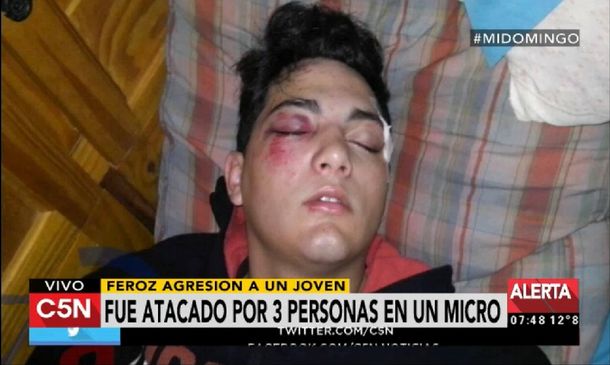 Feroz agresión en un colectivo: lo golpearon con un palo para robarle