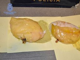 Los implantes mamarios eran bolsas de cocaína