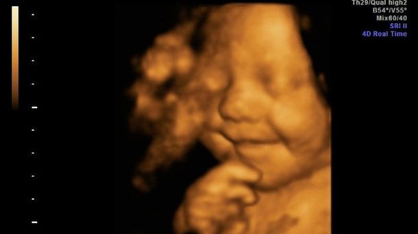 El bebé más feliz del mundo ya sonreía en la panza