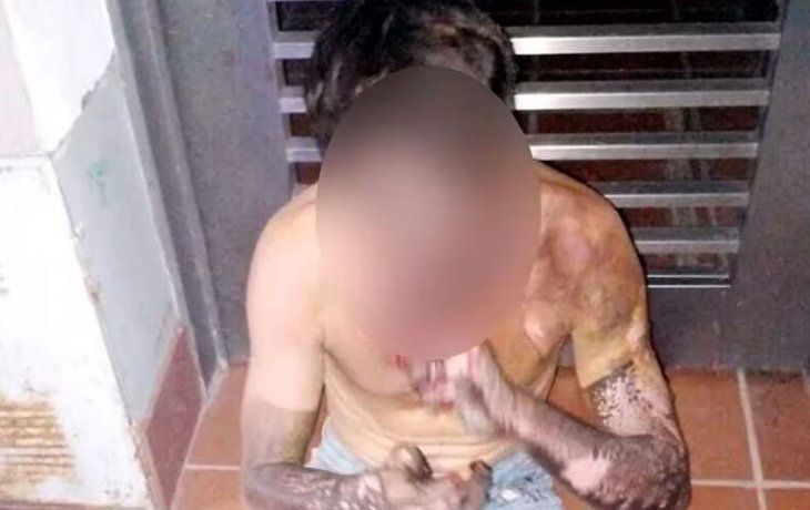 Rosario: se electrocutó un ladrón al intentar robar cables