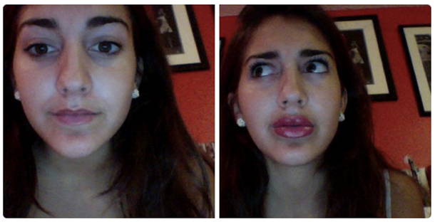 #KylieJennerLipChallenge: peligroso método para tener labios como Kylie Jenner