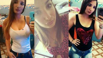 Joven que quemada por su pareja Joven que quemada por su pareja