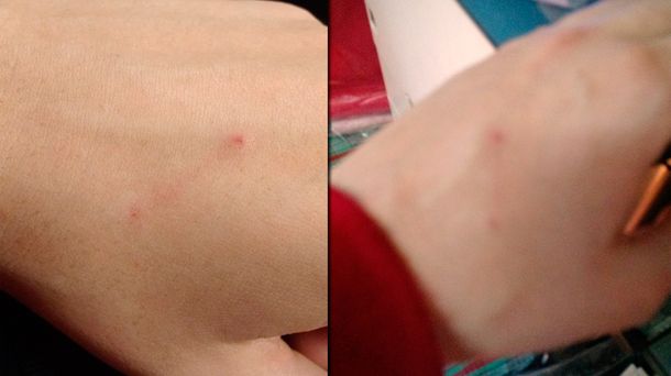 Le pincharon la mano en la calle y sus amigos la salvaron de un secuestro