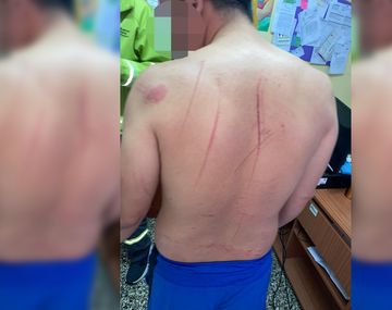 Convivencia en cuarentena: una pelea de pareja terminó con un hombre herido y semidesnudo en la comisaría