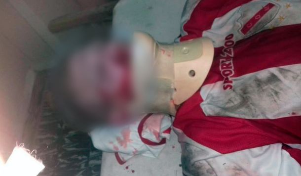 Un futbolista noqueó a otro, lo dejó inconsciente y se fugó en moto