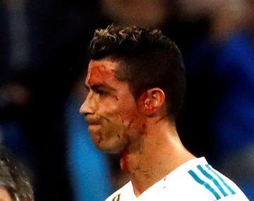 Impresionante: Real Madrid mostró detalles de la profunda herida de CR7