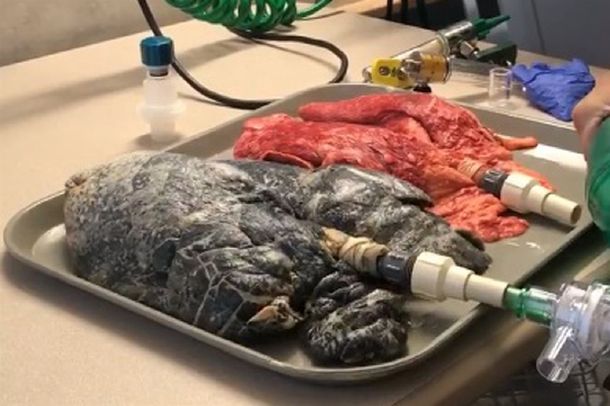 Video: Así respiran los pulmones de un fumador