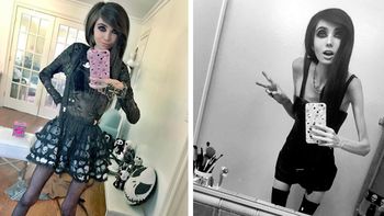 La youtuber Eugenia Cooney, que apenas pesa 27 kilos, es acusada de inducir a la anorexia. La youtuber Eugenia Cooney, que apenas pesa 27 kilos, es acusada de inducir a la anorexia.