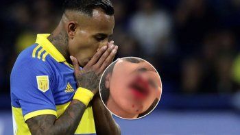 el caso sebastian villa: figura de boca y condenado por violencia de genero en simultaneo el caso sebastian villa: figura de boca y condenado por violencia de genero en simultaneo