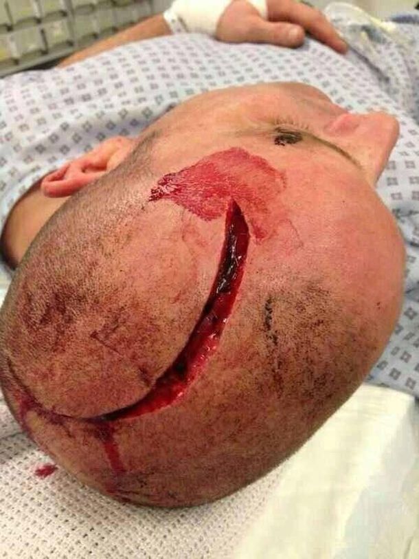 Brutal agresión antisemita en el fútbol europeo