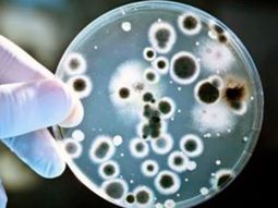 Qué es el Streptococcus Pyogenes, bacteria que ya causó la muerte de 16 personas