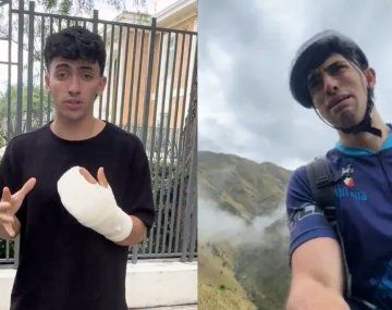 Gero Arias mostró cómo le quedó la mano tras la operación: Están como...