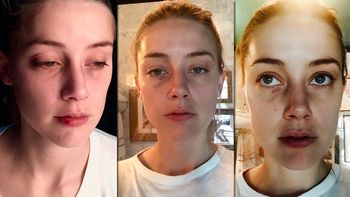 aparecen nuevas fotos de la mujer de johnny depp con golpes en la cara aparecen nuevas fotos de la mujer de johnny depp con golpes en la cara