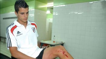 Lamela herida Lamela herida