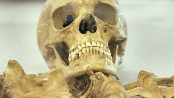 El cráneo de la niña que fue comida El cráneo de la niña que fue comida