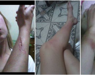 Una modelo denunció a su ex novio por golpes y amenazas de muerte