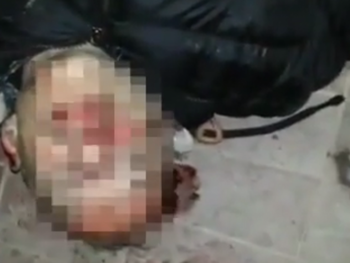 Así dejarpn al delincuente que quería robar la moto