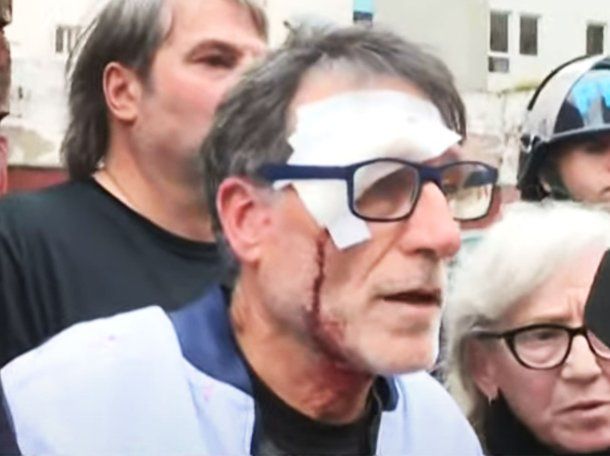 Represión en Congreso: la Policía hirió al Padre Paco en la marcha de jubilados