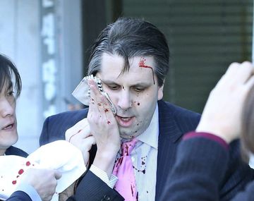 Atacan con un cuchillo al embajador de Estados Unidos en Corea del Sur