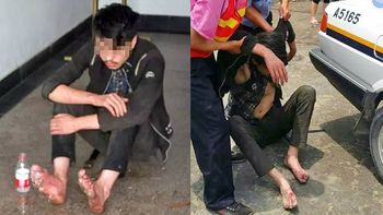 se volvio adicto a los videojuegos y se le pudrieron los pies se volvio adicto a los videojuegos y se le pudrieron los pies