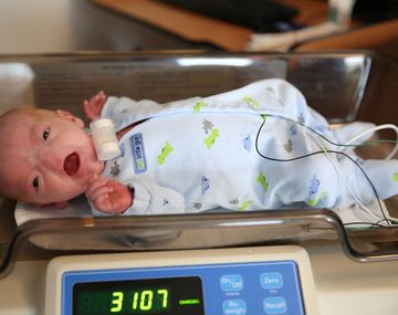 El increíble caso del bebé que nació sin nariz