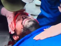 Represión en Recoleta: hirieron al periodista Ezequiel Guazzora