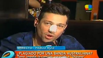 pablito ruiz reaparecio tras su multiple cirugia estetica pablito ruiz reaparecio tras su multiple cirugia estetica