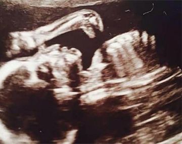 Encuentran un dinosaurio en una ecografía