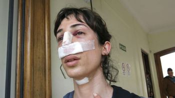 Quimey decidió emprender el cambio de género en pleno año escolar Quimey decidió emprender el cambio de género en pleno año escolar