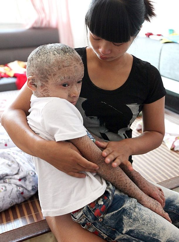 Conmueve a China el extraño caso del niño pez