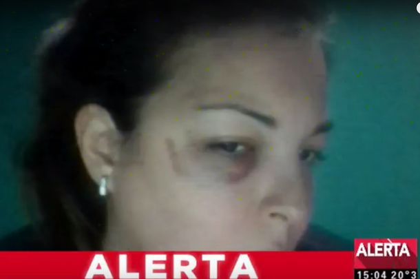 Brutal ataque a una embarazada: su ex pareja la desfiguró y la arrastró