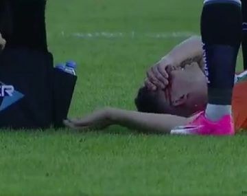 ¿Era roja? El feroz codazo de Triveiro a Sporle