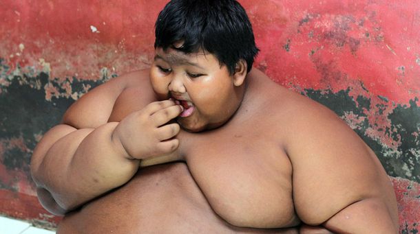 Temen por la vida del niño más obeso del mundo: pesa 192 kilos a los 10 años