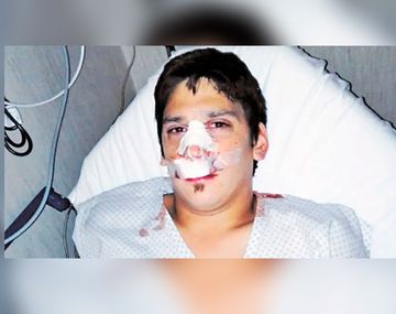 Festejaba el cumpleaños de su hermana y fue brutalmente atacado por patovicas