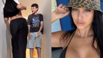 flor regidor mostro el resultado de su cirugia: presentacion de ellas flor regidor mostro el resultado de su cirugia: presentacion de ellas