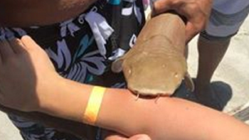 fue atacada por un tiburon de medio metro y le quedo atrapado del brazo fue atacada por un tiburon de medio metro y le quedo atrapado del brazo