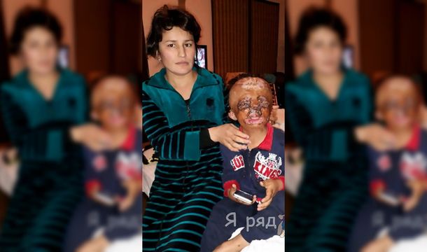 Un niño quemado le escribió una carta a Papá Noel para pedirle una cara nueva