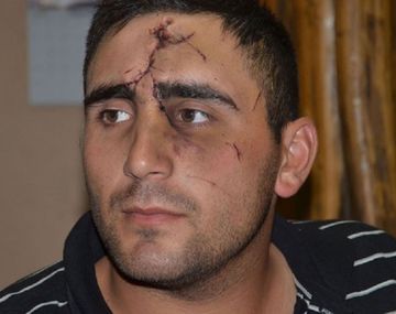 Le desfiguraron la cara por hacerse policía