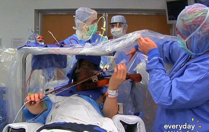 El increíble video en el que un violinista toca su instrumento mientras lo operan del cerebro