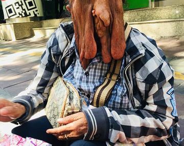 La mujer, de 63 años, teme morir en la operación