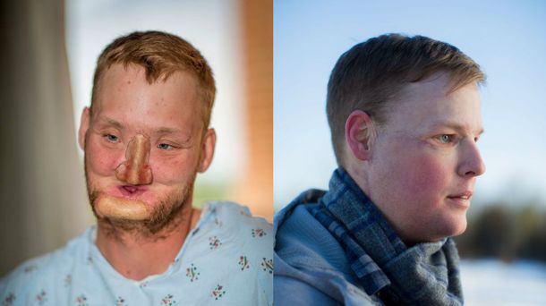 Antes y después de Andy Sandness