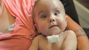 un bebe sobrevive gracias a una impresora 3d un bebe sobrevive gracias a una impresora 3d