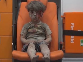 Otra tragedia golpeó a Omran, el nene sirio cuya foto se viralizó esta semana