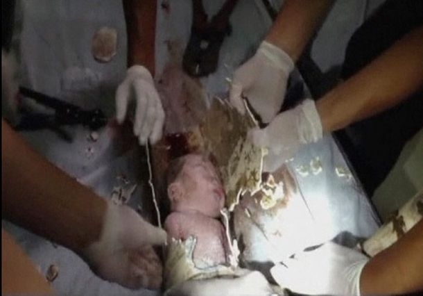 Rescatan a un bebé que fue abandonado en una cloaca