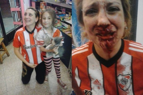 Una hincha de River fue salvajemente atacada por un fanático de Boca