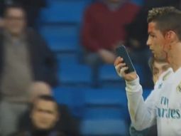 Cristiano Ronaldo se cortó la cara y pidió mirarse con un celular Cristiano Ronaldo se cortó la cara y pidió mirarse con un celular